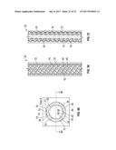 BAFFLE INSERT FOR A GAS TURBINE ENGINE COMPONENT diagram and image