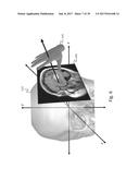 SYSTEMS AND USER INTERFACES FOR DYNAMIC INTERACTION WITH TWO-AND     THREE-DIMENSIONAL MEDICAL IMAGE DATA USING HAND GESTURES diagram and image