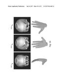 SYSTEMS AND USER INTERFACES FOR DYNAMIC INTERACTION WITH TWO-AND     THREE-DIMENSIONAL MEDICAL IMAGE DATA USING HAND GESTURES diagram and image