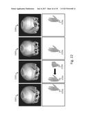 SYSTEMS AND USER INTERFACES FOR DYNAMIC INTERACTION WITH TWO-AND     THREE-DIMENSIONAL MEDICAL IMAGE DATA USING HAND GESTURES diagram and image