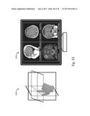 SYSTEMS AND USER INTERFACES FOR DYNAMIC INTERACTION WITH TWO-AND     THREE-DIMENSIONAL MEDICAL IMAGE DATA USING HAND GESTURES diagram and image