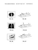 PATHWAY PLANNING SYSTEM AND METHOD diagram and image