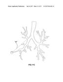 PATHWAY PLANNING SYSTEM AND METHOD diagram and image