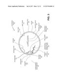 MICROPHONE ASSEMBLY HAVING AN ACOUSTIC LEAK PATH diagram and image