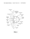 MICROPHONE ASSEMBLY HAVING AN ACOUSTIC LEAK PATH diagram and image