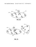 PARTIALLY SYNCHRONIZED MULTILATERATION OR TRILATERATION METHOD AND SYSTEM     FOR POSITIONAL FINDING USING RF diagram and image