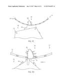 Plant Trimming Device diagram and image