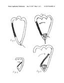 PET LEASH HANDLE diagram and image