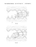 INFLATABLE BALLOON HOOD diagram and image