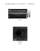 AUTOMATIC THREE-DIMENSIONAL SEGMENTATION METHOD FOR OCT AND DOPPLER OCT     ANGIOGRAPHY diagram and image