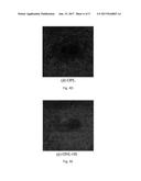 AUTOMATIC THREE-DIMENSIONAL SEGMENTATION METHOD FOR OCT AND DOPPLER OCT     ANGIOGRAPHY diagram and image