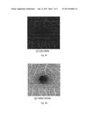 AUTOMATIC THREE-DIMENSIONAL SEGMENTATION METHOD FOR OCT AND DOPPLER OCT     ANGIOGRAPHY diagram and image