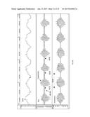 REAL-TIME DETECTION OF PERIODIC BREATHING diagram and image