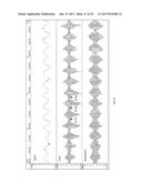 REAL-TIME DETECTION OF PERIODIC BREATHING diagram and image