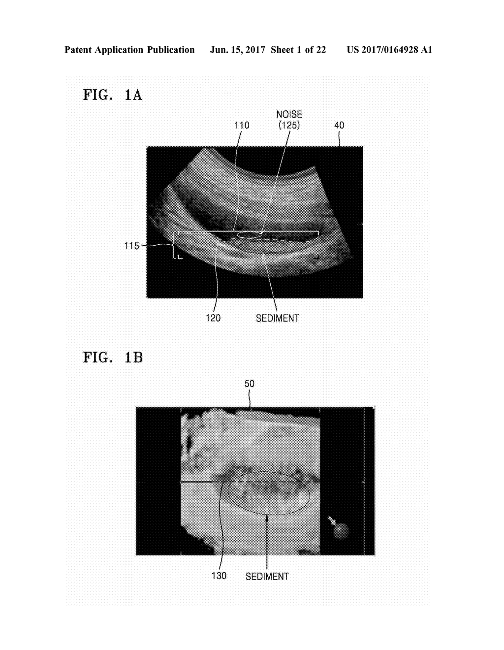 ULTRASOUND APPARATUS AND METHOD OF DISPLAYING ULTRASOUND IMAGES - diagram, schematic, and image 02