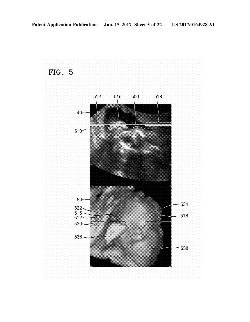 ULTRASOUND APPARATUS AND METHOD OF DISPLAYING ULTRASOUND IMAGES - diagram, schematic, and image 06