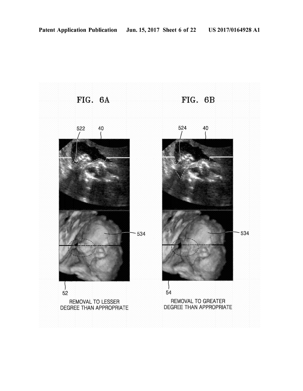 ULTRASOUND APPARATUS AND METHOD OF DISPLAYING ULTRASOUND IMAGES - diagram, schematic, and image 07