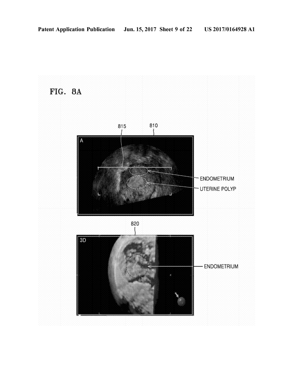 ULTRASOUND APPARATUS AND METHOD OF DISPLAYING ULTRASOUND IMAGES - diagram, schematic, and image 10