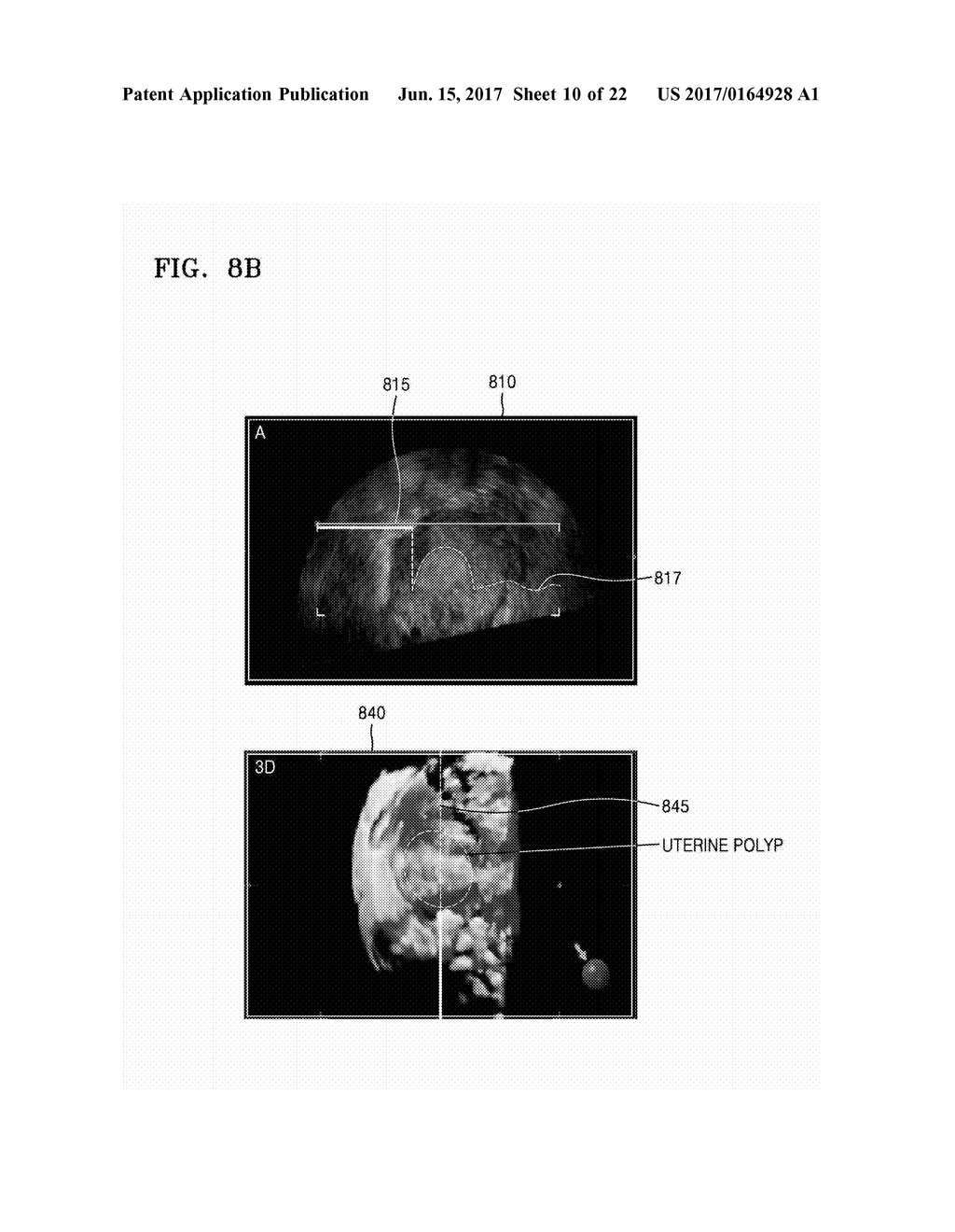 ULTRASOUND APPARATUS AND METHOD OF DISPLAYING ULTRASOUND IMAGES - diagram, schematic, and image 11