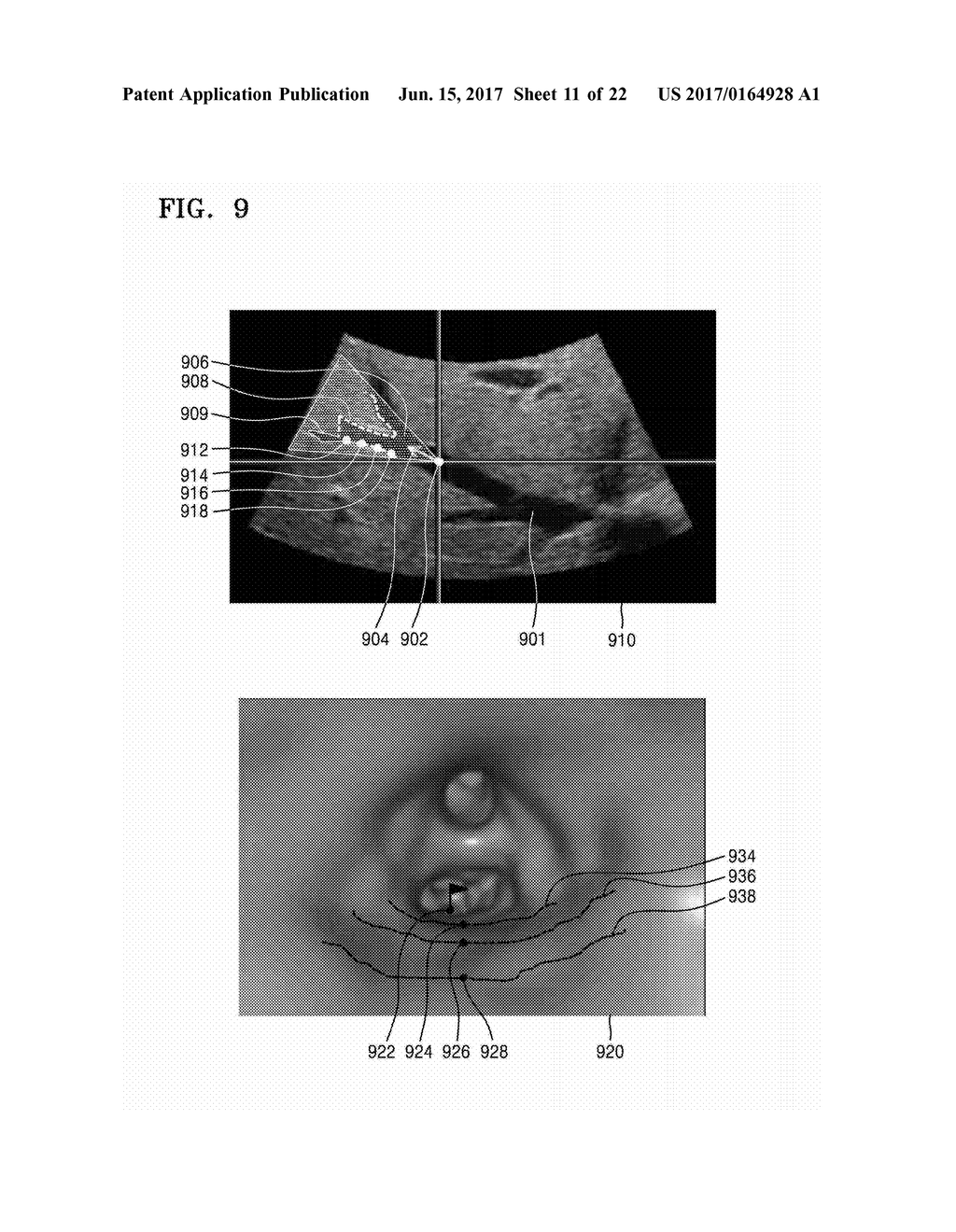 ULTRASOUND APPARATUS AND METHOD OF DISPLAYING ULTRASOUND IMAGES - diagram, schematic, and image 12