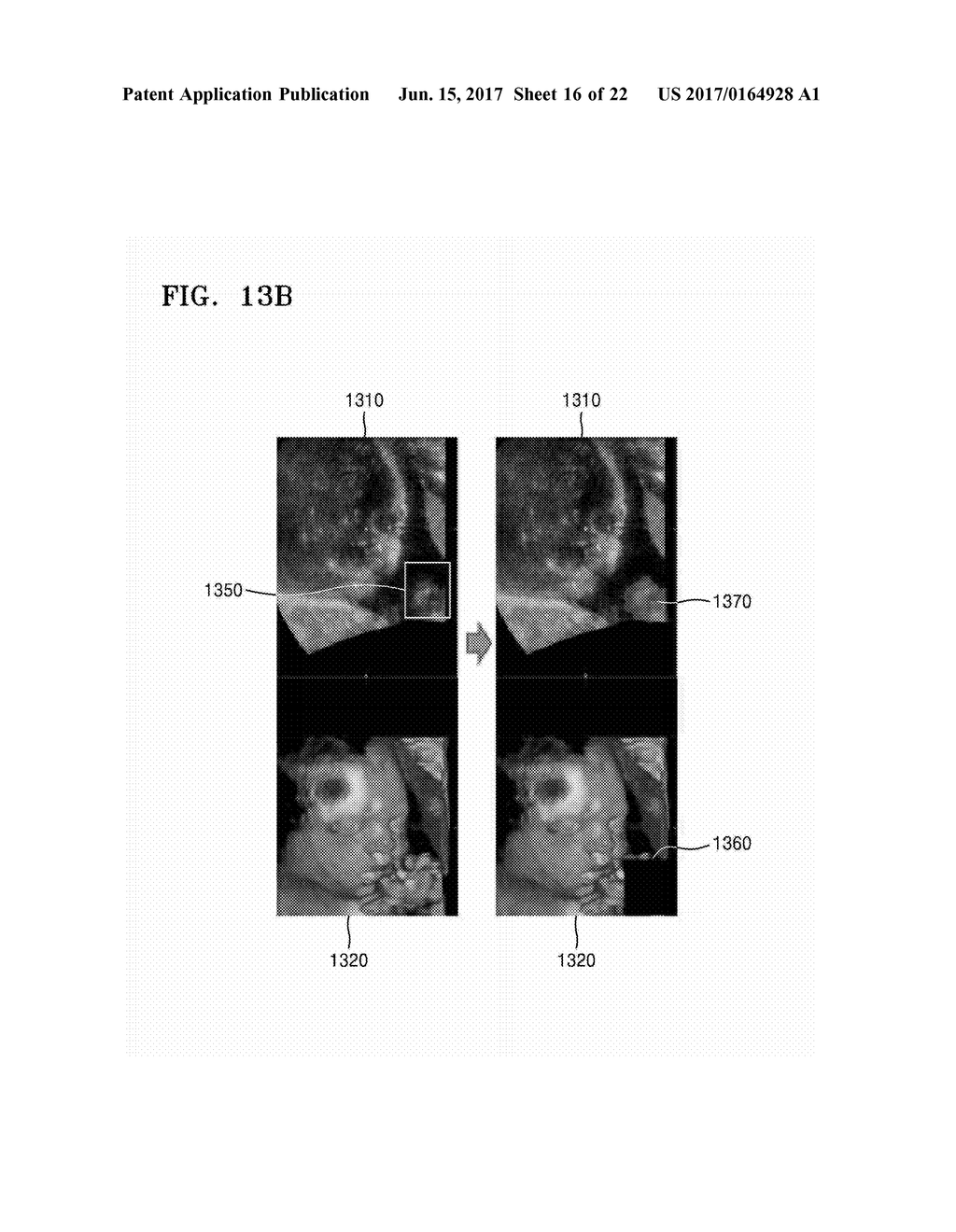 ULTRASOUND APPARATUS AND METHOD OF DISPLAYING ULTRASOUND IMAGES - diagram, schematic, and image 17