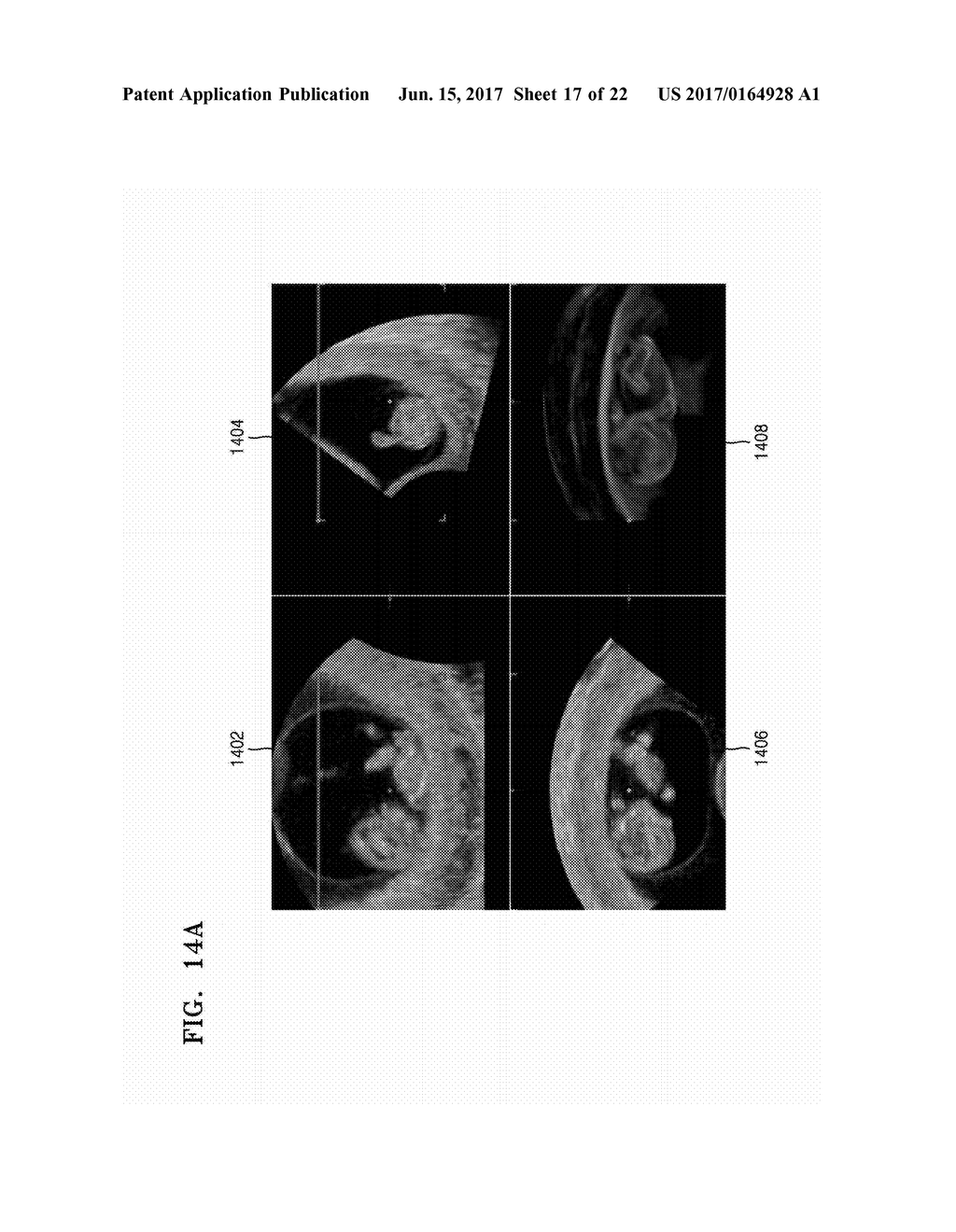 ULTRASOUND APPARATUS AND METHOD OF DISPLAYING ULTRASOUND IMAGES - diagram, schematic, and image 18