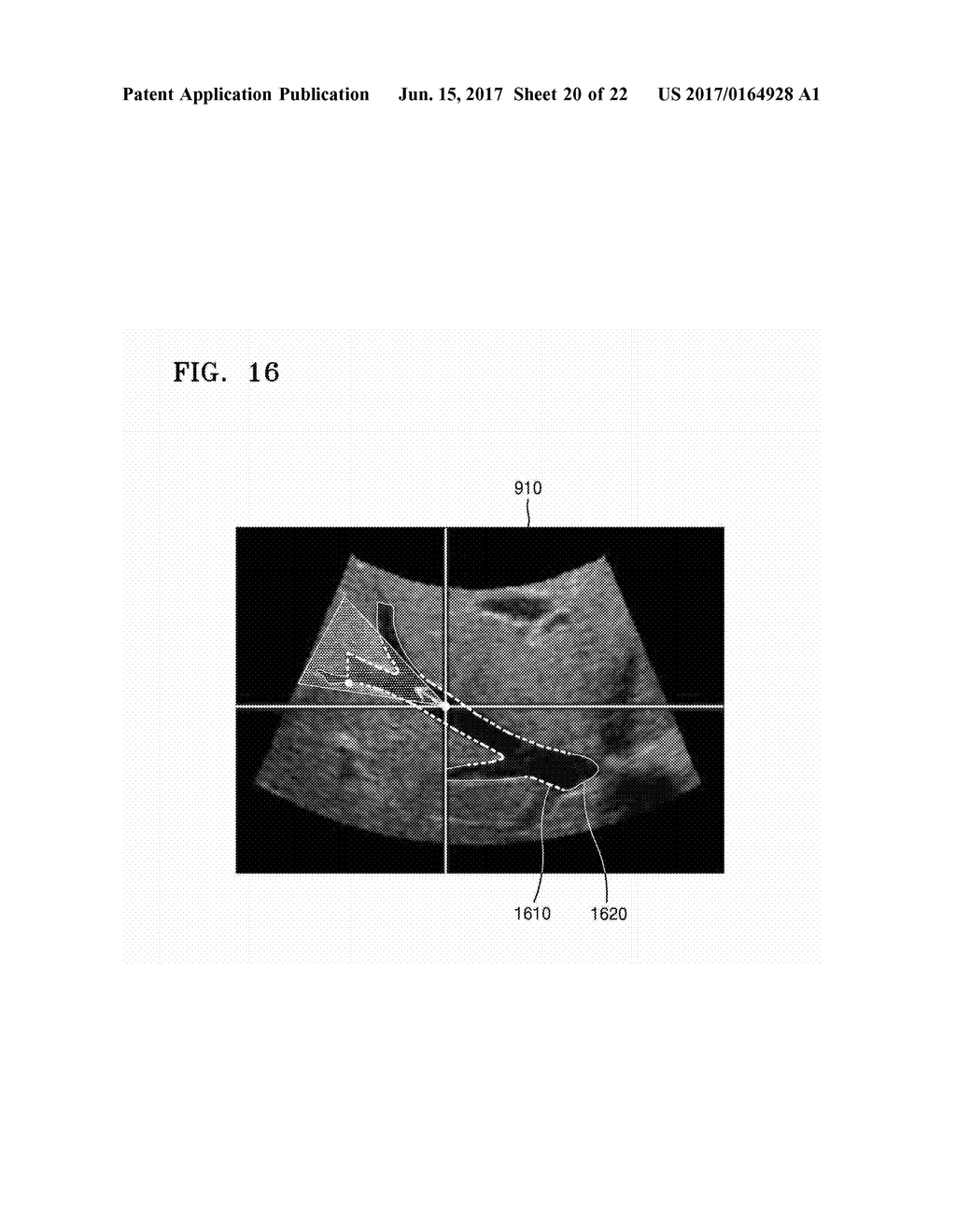 ULTRASOUND APPARATUS AND METHOD OF DISPLAYING ULTRASOUND IMAGES - diagram, schematic, and image 21