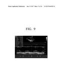 ULTRASOUND APPARATUS, CONTROLLING METHOD THEREOF AND TELEMEDICINE SYSTEM diagram and image