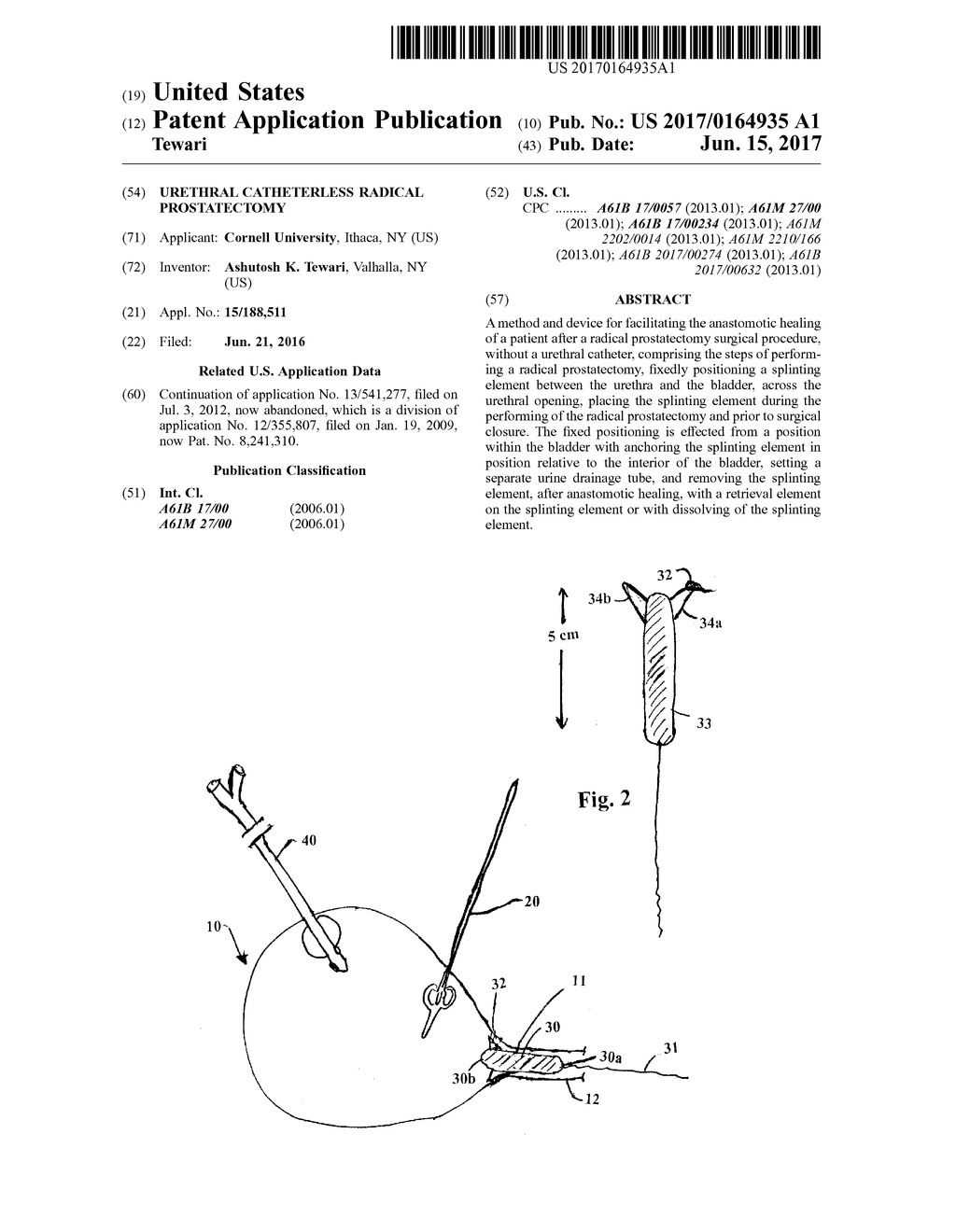 URETHRAL CATHETERLESS RADICAL PROSTATECTOMY - diagram, schematic, and image 01