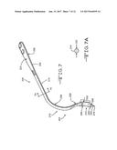 RETRACTOR TOOLS FOR MINIMALLY INVASIVE HIP SURGERY diagram and image