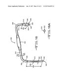 RETRACTOR TOOLS FOR MINIMALLY INVASIVE HIP SURGERY diagram and image