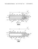 SUTURE ANCHOR WITH INSERT-MOLDED RIGID MEMBER diagram and image