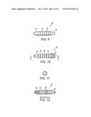 SUTURE ANCHOR WITH INSERT-MOLDED RIGID MEMBER diagram and image