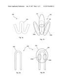 ANCHOR FOR SHAPE MEMORY ALLOY WIRE AND ACTUATOR diagram and image