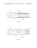 VESSEL FLOW CONTROL DEVICES AND METHODS diagram and image