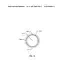 VESSEL FLOW CONTROL DEVICES AND METHODS diagram and image