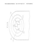 SURGICAL VIEWING SYSTEM diagram and image