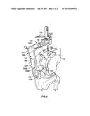 ASSOCIATED INSTRUMENTS AND METHODS FOR POSTERIOR STABILIZED KNEE     PREPARATION diagram and image