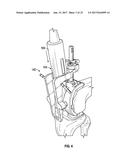 ASSOCIATED INSTRUMENTS AND METHODS FOR POSTERIOR STABILIZED KNEE     PREPARATION diagram and image