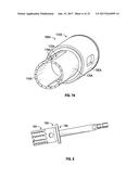 ASSOCIATED INSTRUMENTS AND METHODS FOR POSTERIOR STABILIZED KNEE     PREPARATION diagram and image