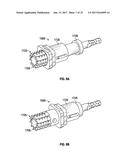 ASSOCIATED INSTRUMENTS AND METHODS FOR POSTERIOR STABILIZED KNEE     PREPARATION diagram and image