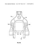 ASSOCIATED INSTRUMENTS AND METHODS FOR POSTERIOR STABILIZED KNEE     PREPARATION diagram and image