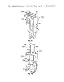 ASSOCIATED INSTRUMENTS AND METHODS FOR POSTERIOR STABILIZED KNEE     PREPARATION diagram and image