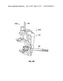 ASSOCIATED INSTRUMENTS AND METHODS FOR POSTERIOR STABILIZED KNEE     PREPARATION diagram and image