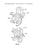 ASSOCIATED INSTRUMENTS AND METHODS FOR POSTERIOR STABILIZED KNEE     PREPARATION diagram and image