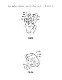 ASSOCIATED INSTRUMENTS AND METHODS FOR POSTERIOR STABILIZED KNEE     PREPARATION diagram and image