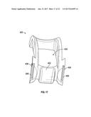 ASSOCIATED INSTRUMENTS AND METHODS FOR POSTERIOR STABILIZED KNEE     PREPARATION diagram and image