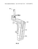 ASSOCIATED INSTRUMENTS AND METHODS FOR POSTERIOR STABILIZED KNEE     PREPARATION diagram and image