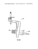 ASSOCIATED INSTRUMENTS AND METHODS FOR POSTERIOR STABILIZED KNEE     PREPARATION diagram and image