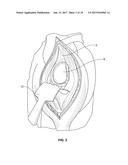 SHAPE-FIT GLENOID REAMING SYSTEMS AND METHODS diagram and image